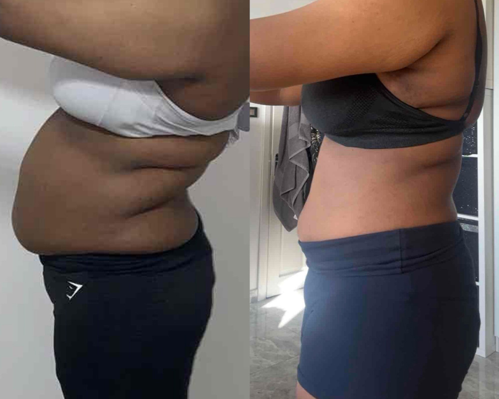 Transformation 1