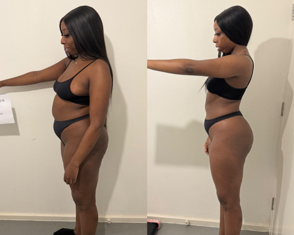 Transformation 4